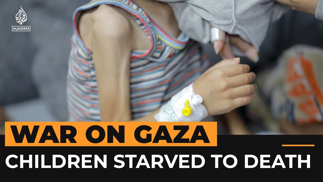Not just Bombs: Israeli-caused Hunger is killing Palestinian Children in Gaza